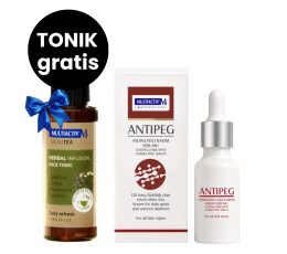 ANTIPEG SERUM ZA IZBELJIVANJE PEGA I FLEKA
