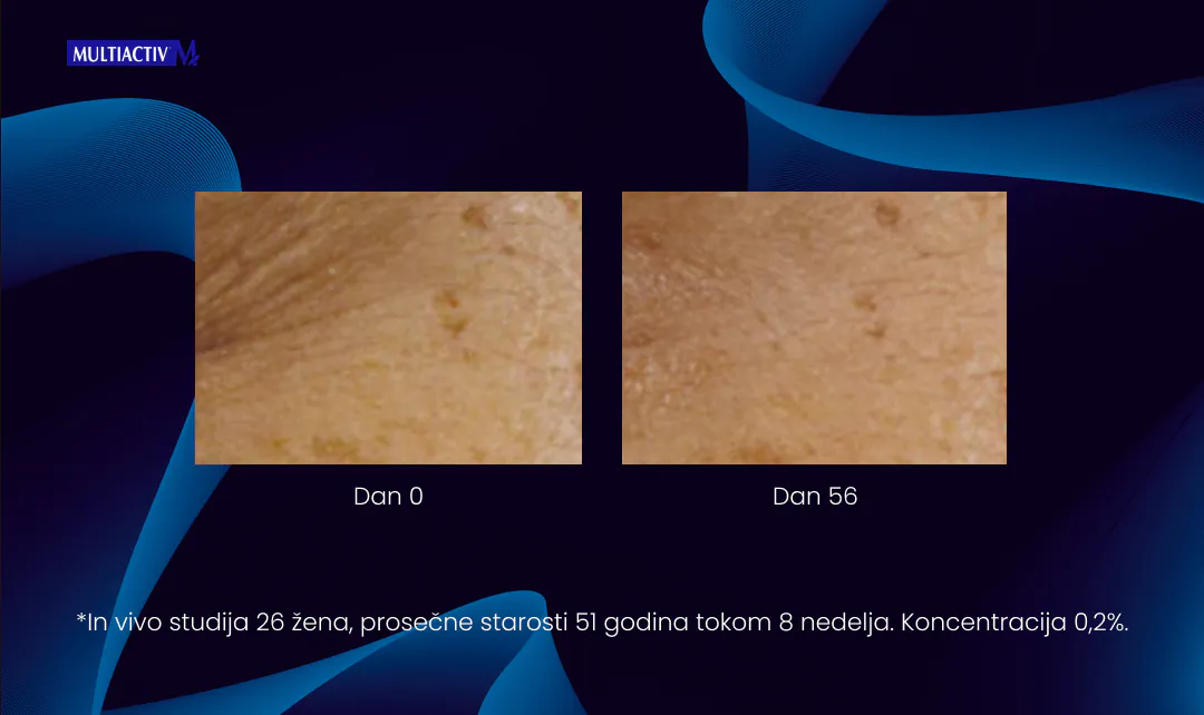 Peptidi: Najnovije otkriće za podmlađivanje kože! 3 Blog Anti Age 3