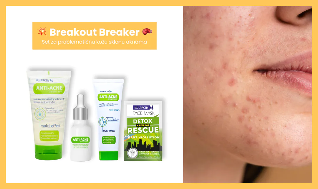 BACK TO SCHOOL SKINCARE - Rutina nege lica za đake i studente 2 Blog Back to School 2