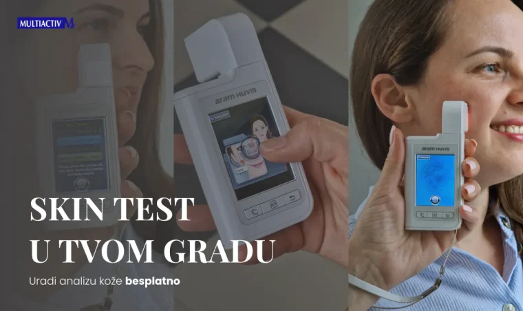 Besplatna dijagnostika kože lica: Otkrijte tajne Vaše kože!