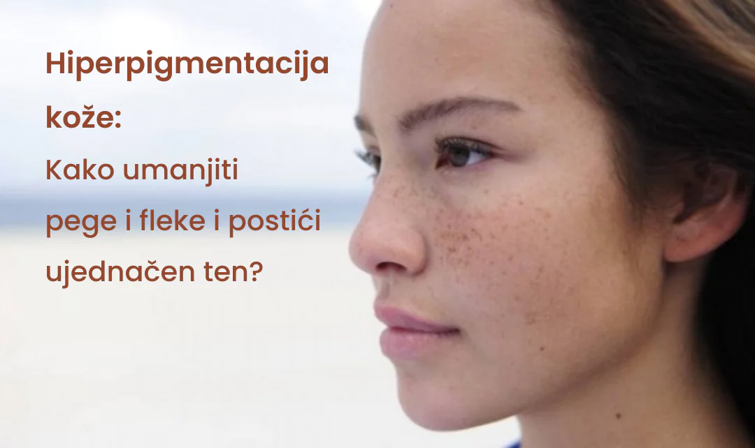 Hiperpigmentacija kože: kako umanjiti pege i fleke i postići ujednačen ten? 1 Blog slike 11